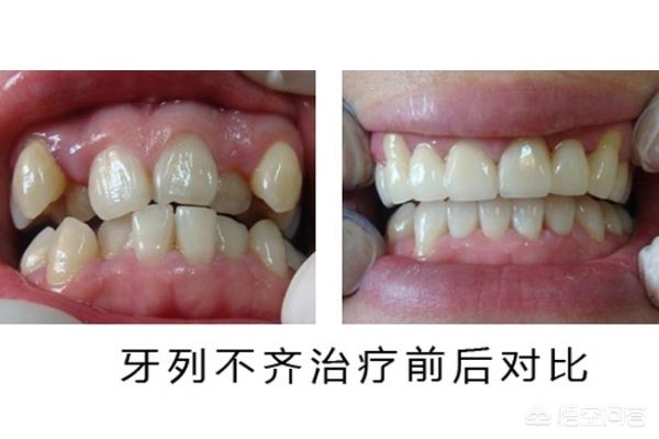 平阳最新24小时牙医在线咨询方法分析(最方便真实的平阳有没有24小时牙医方法)